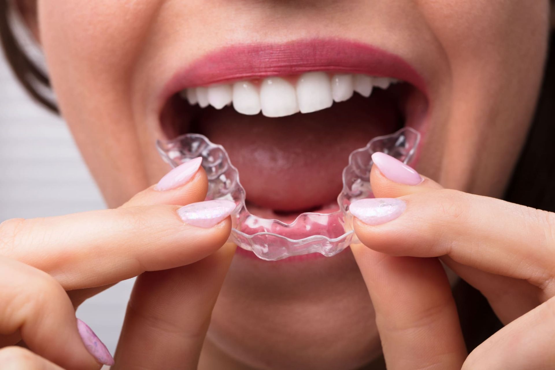 Disturbi della dentizione? Impara a conoscerne cause, sintomi e i rimedi