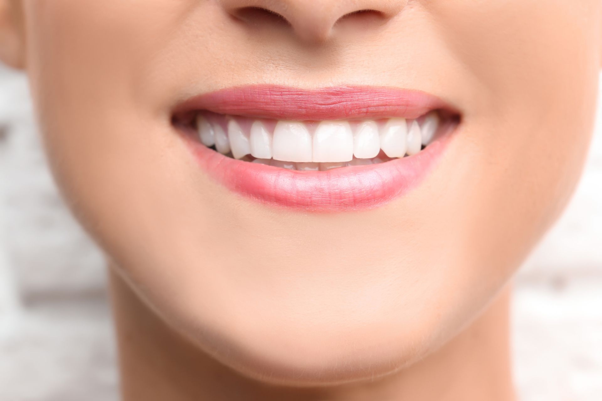 Sorriso denti bianchi
