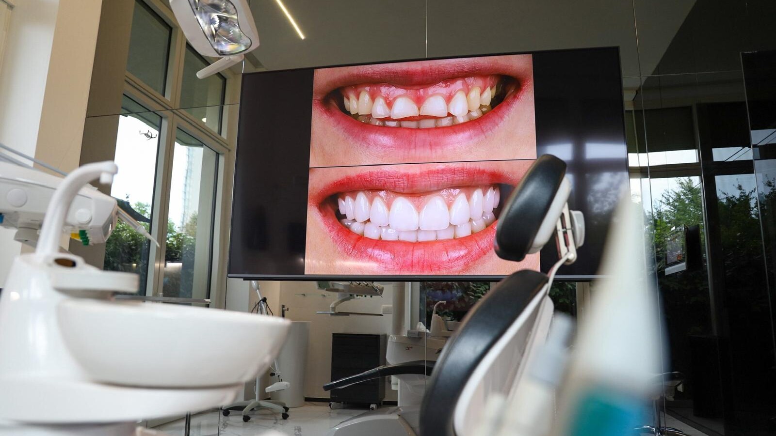Valutazione del sorriso prima di un trattamento con faccette dentali